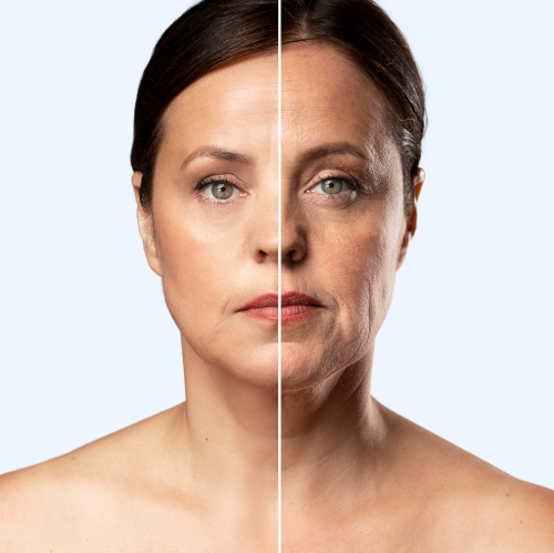 ForeverYoung™ -Anti-Aging Collagen - 70% OFF TODAY ONLY!