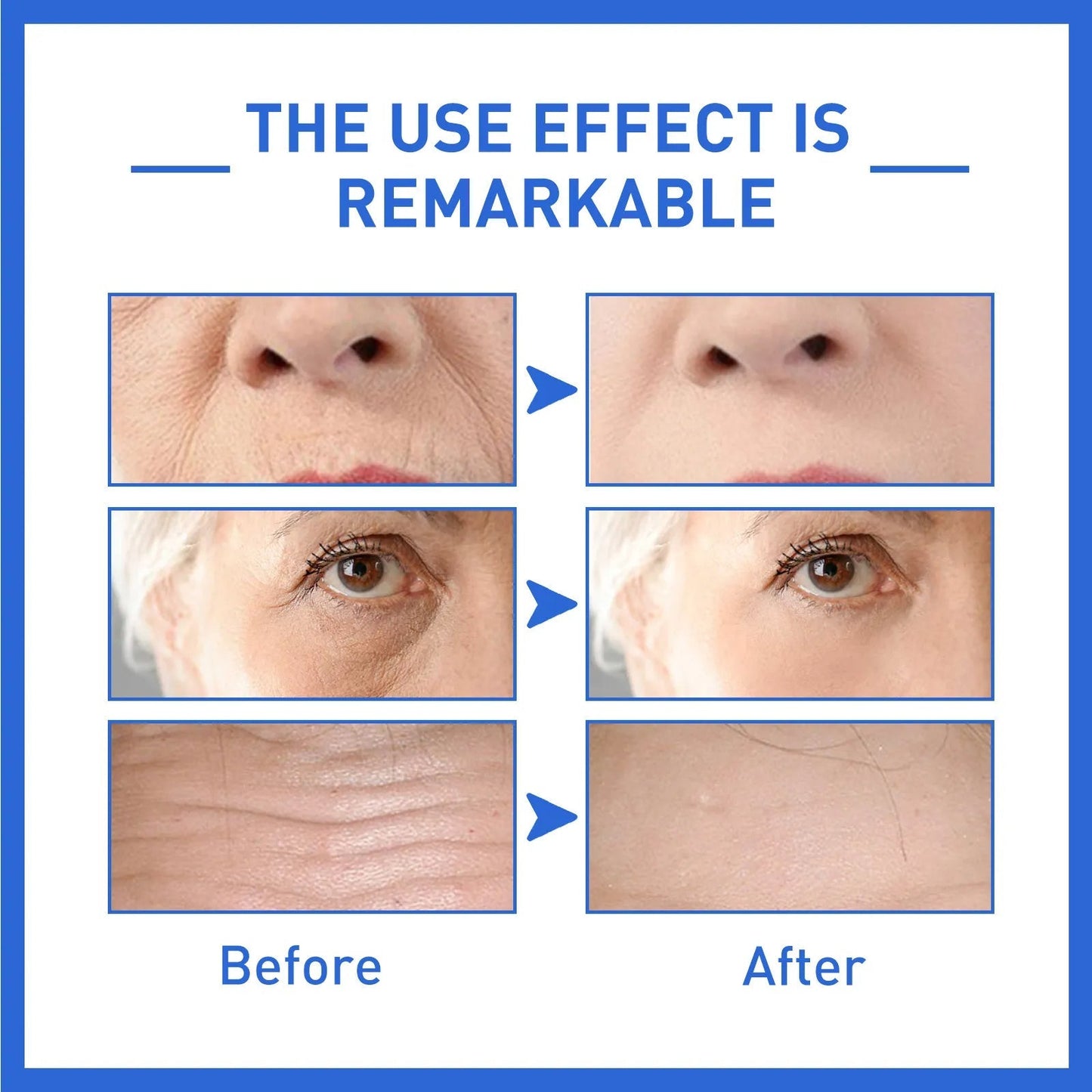 ForeverYoung™ -Anti-Aging Collagen - 70% OFF TODAY ONLY!