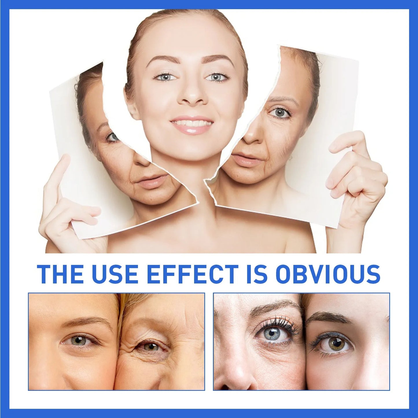ForeverYoung™ -Anti-Aging Collagen - 70% OFF TODAY ONLY!