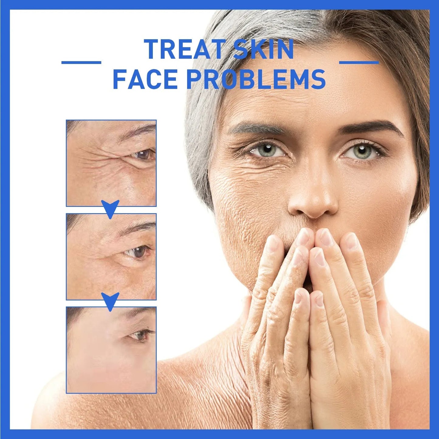ForeverYoung™ -Anti-Aging Collagen - 70% OFF TODAY ONLY!